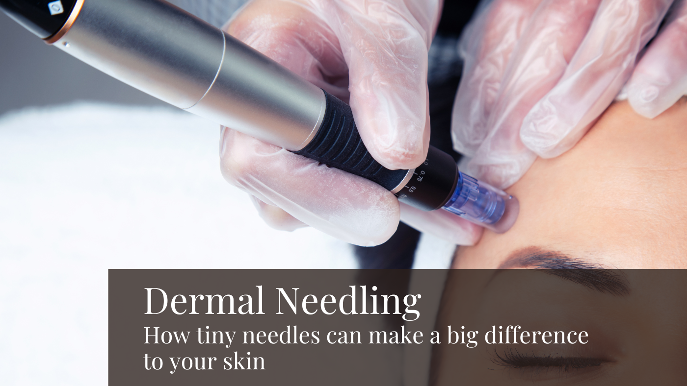 Dermal Needling: How tiny needles can make a big difference to your skin