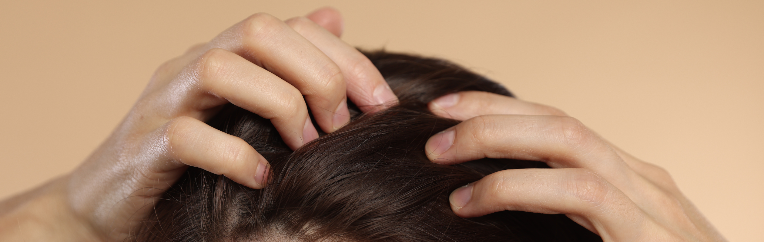 Why Is My Scalp So Itchy? Understanding Dandruff and Your Scalp Microbiome