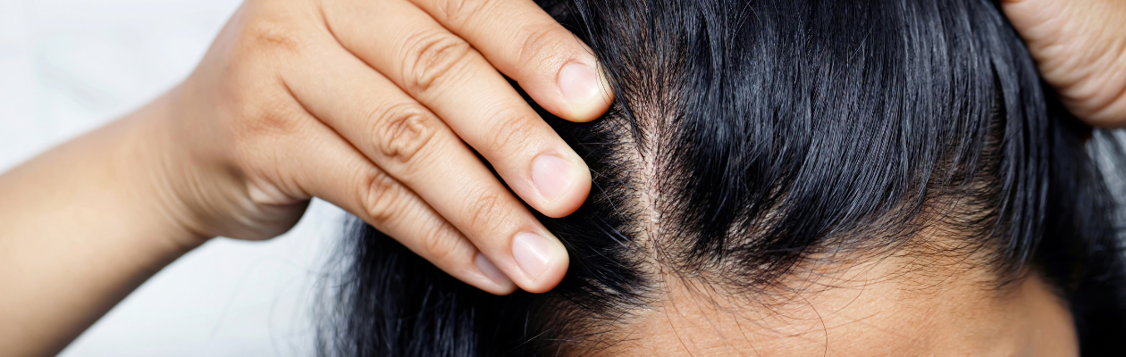 Oily Scalp 101: Why Your Hair Feels Greasy So Fast