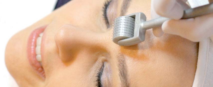 Derma-rolling | Skin Needling